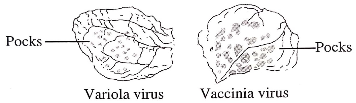 Pocks produced by variola virus and vaccina virus