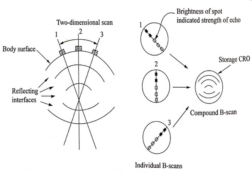 B Scan display
