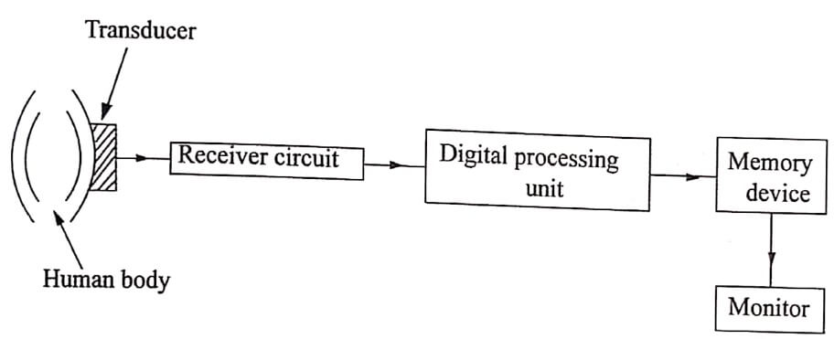 Block diagram of sonogram